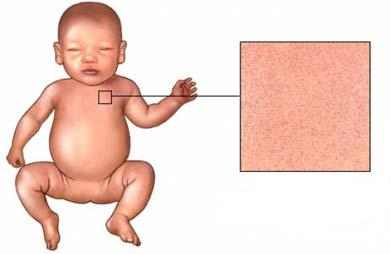 диарея у ребенка 7 месяцев