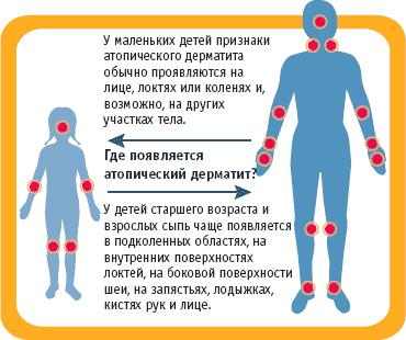 лечение запора у грудного ребенка комаровский