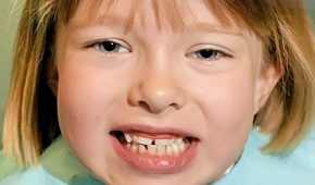 лечить зубы ребенку в минске