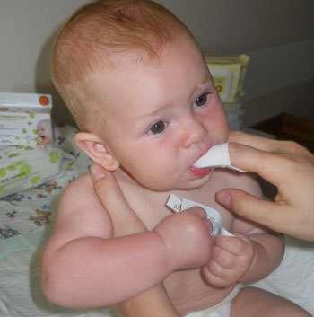 молочница во рту у ребенка 4 года