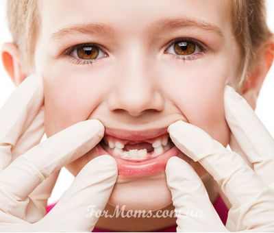 молочные и постоянные зубы у детей