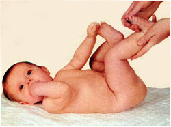 низкий тонус мышц у ребенка лечение видео