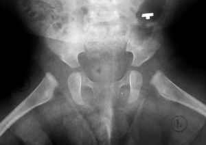 Рентген тазобедренного сустава ребенку где сделать